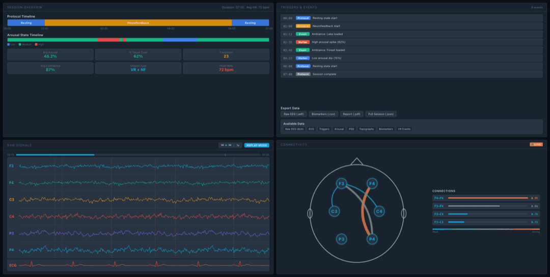 Post-session analysis dashboard with raw EEG, brain state evolution, and data export